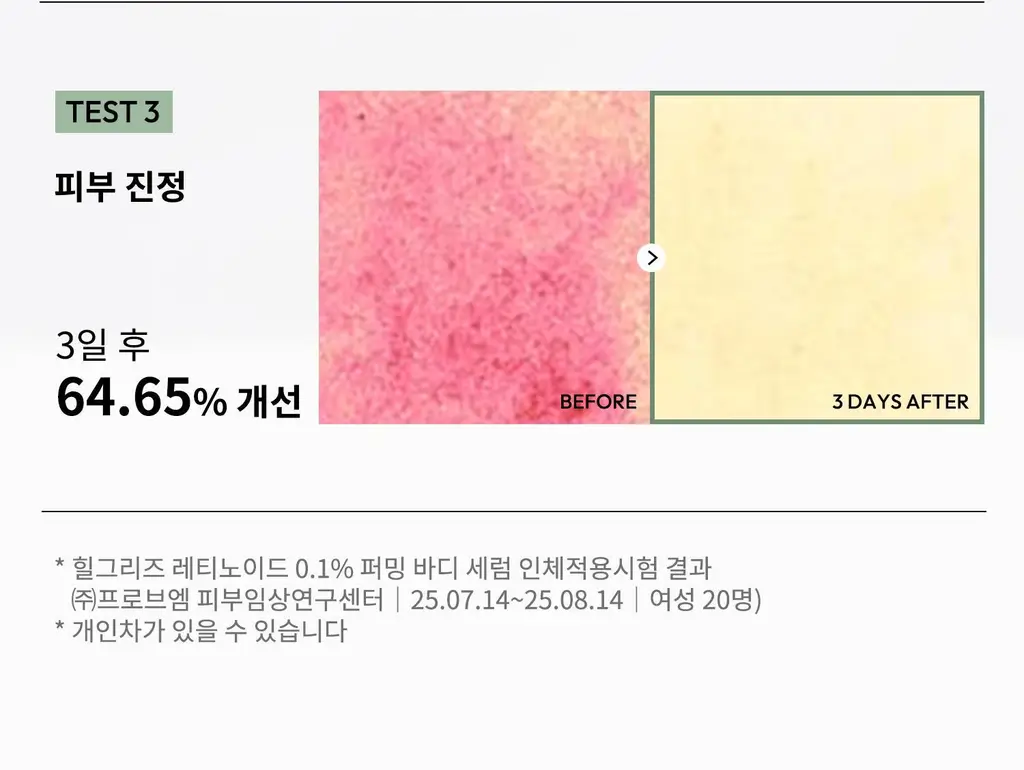 [탄력/목주름 개선] 힐그리즈 레티노이드 0.1% 퍼밍 바디 세럼 150ml 상세페이지 16